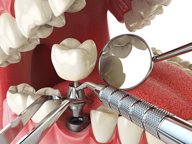Best Emergency Broken Tooth Repair in Windsor, IL